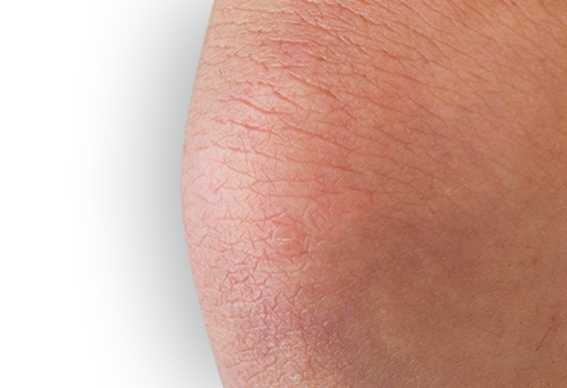 O'Keeffe's Skin Repair result